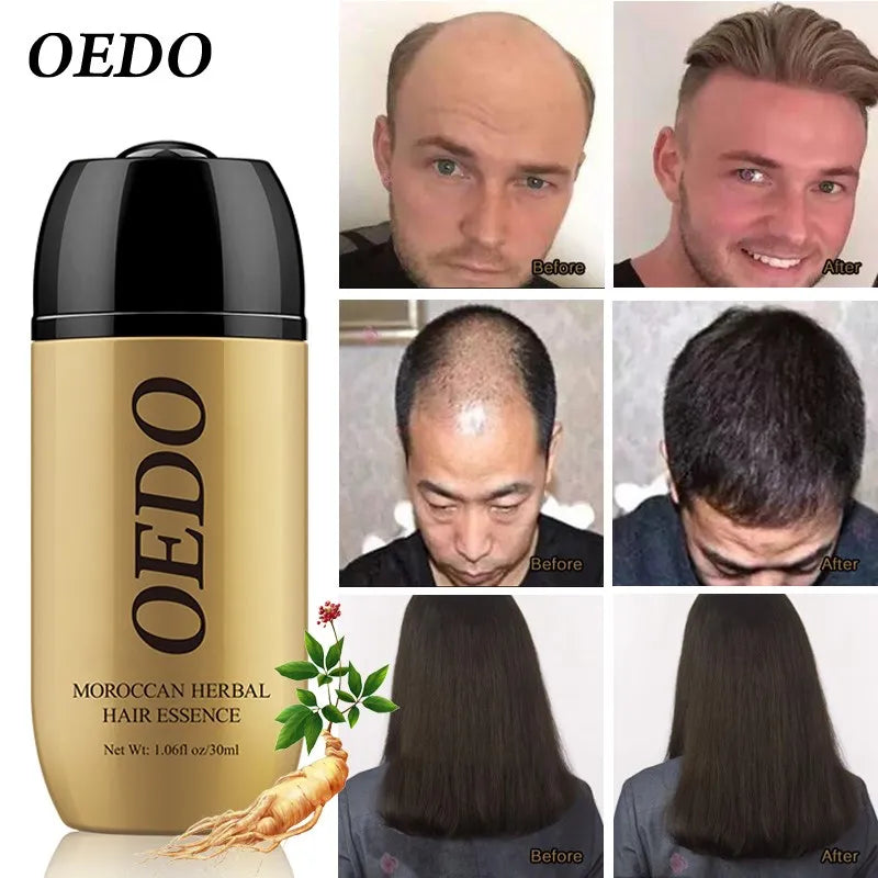Morocco ginseng hair treatment for men and women, hair growth serum repair shampoo. - My Store