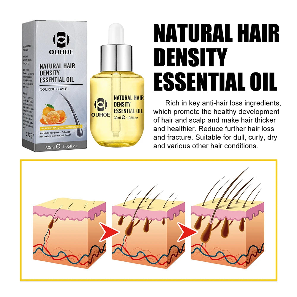 Hair thickening essential oil that  moisturizes, repairs, and strengthens hair with natural ginger. - My Store