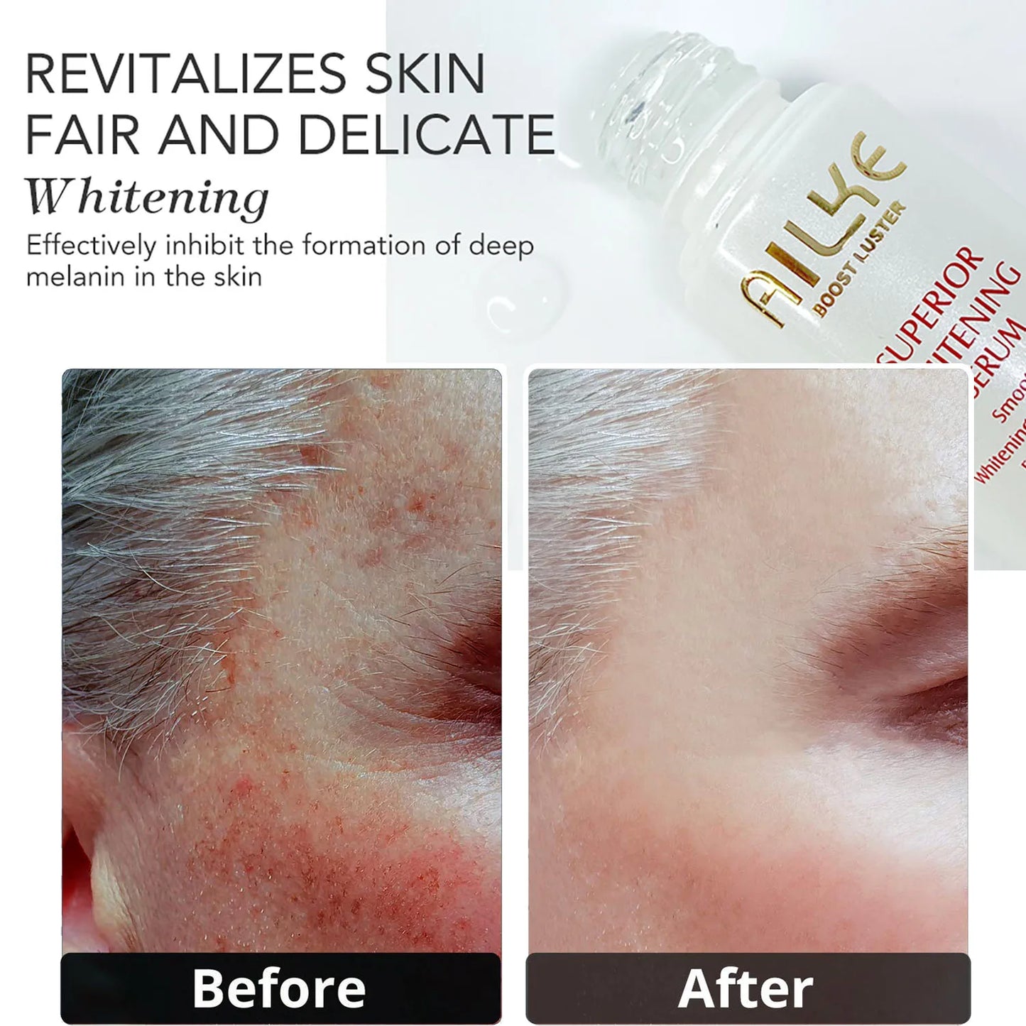 Whitening Face Serum for dark Spots, freckles, evens  skin tone, and is hydrating. - My Store